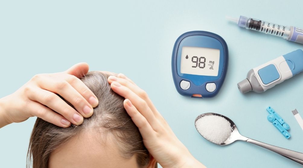 Diabetes Cause Hair Thinning